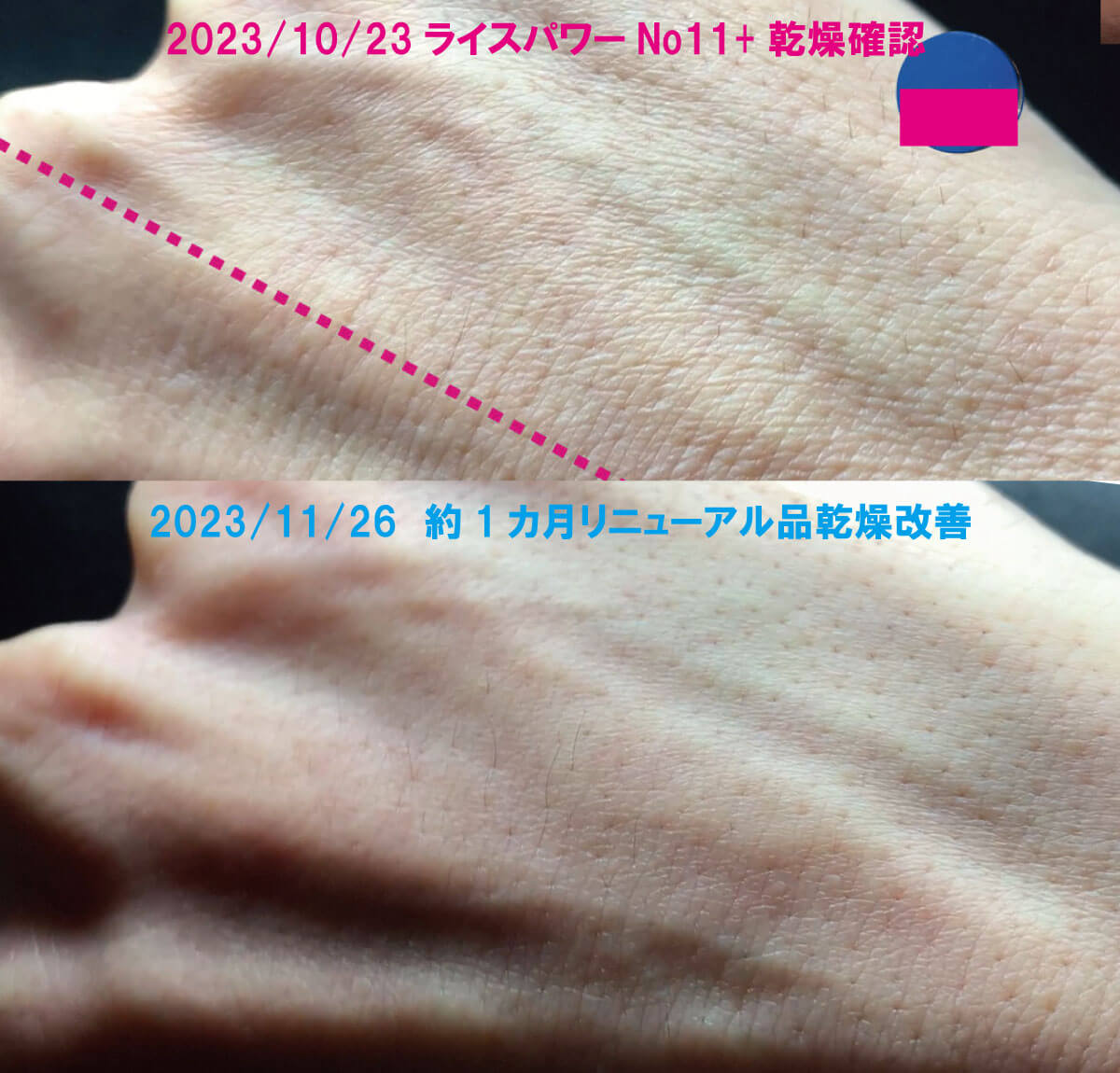 あなたが現在見ているのは ライスパワーNo11+比較テスト開始